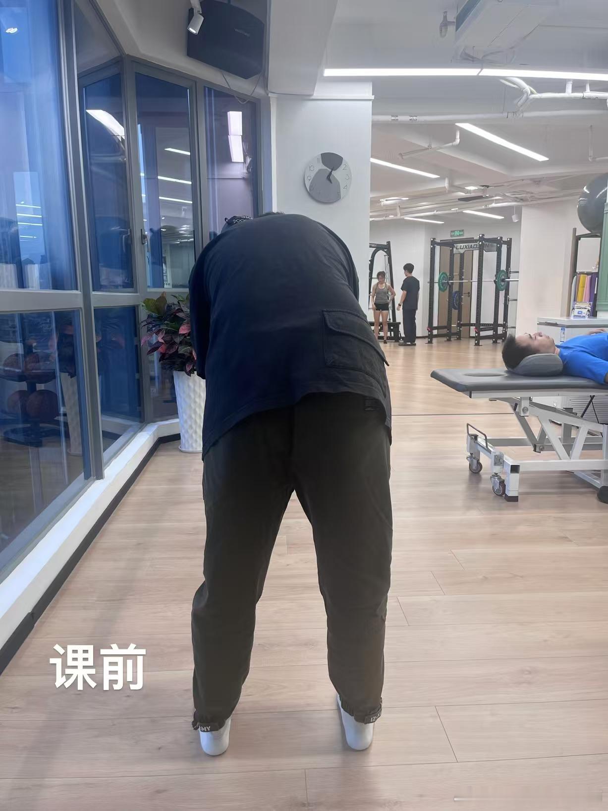 腰突  广州店的小哥，既有脊柱侧弯又有腰突，屋漏偏风连阴雨了[生病]，刚来的时候
