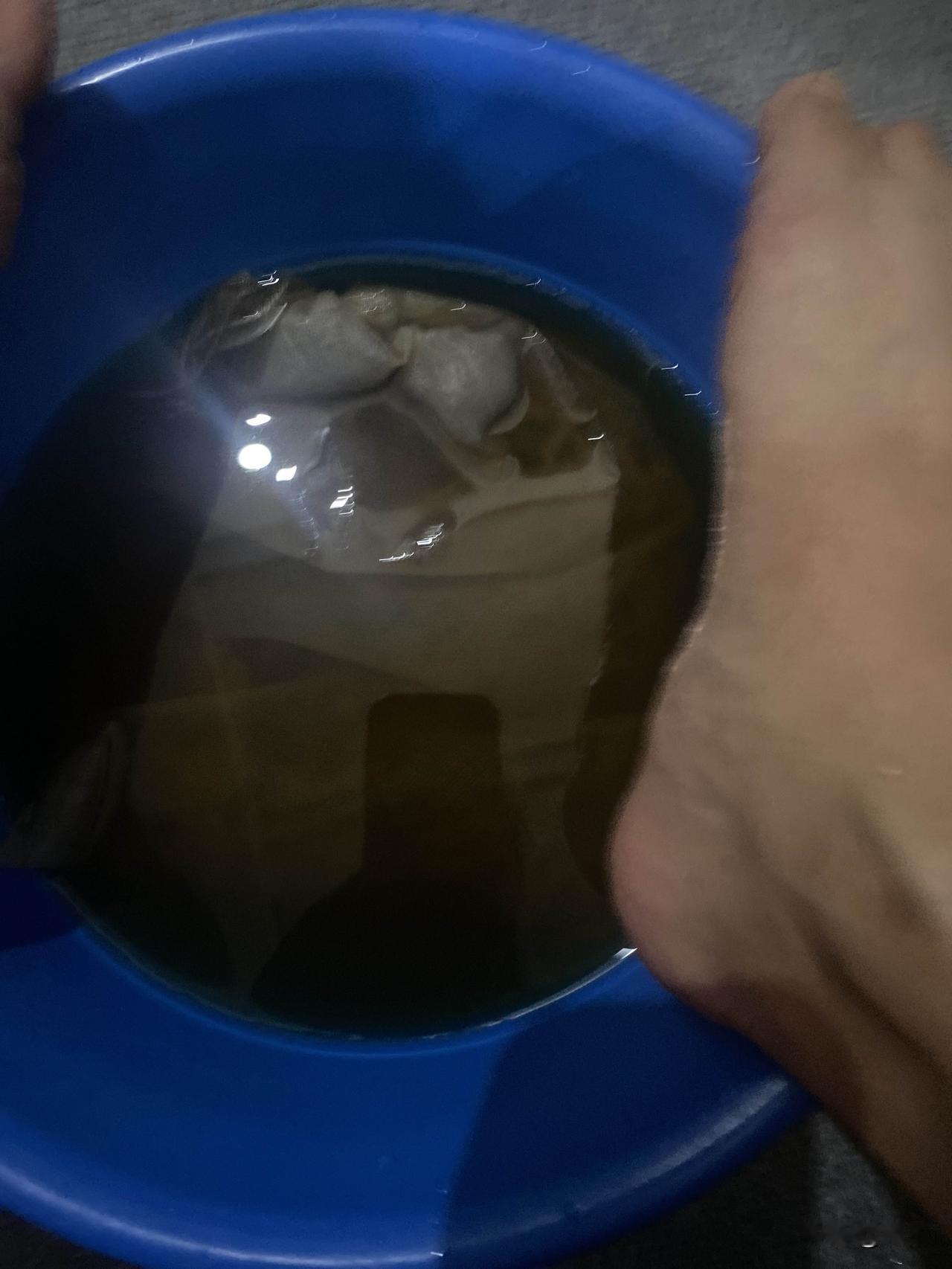 中药泡脚，先喝后泡，一付中药熬两次都喝掉，第三次就熬了拿来泡脚，医生说这样可以祛