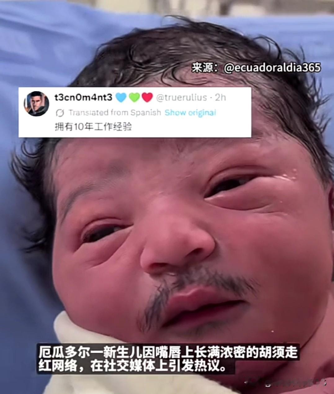 国外新生儿一出生就带着小胡子，网友笑疯：怕不是自带十年工龄
 
别的新生儿大多光