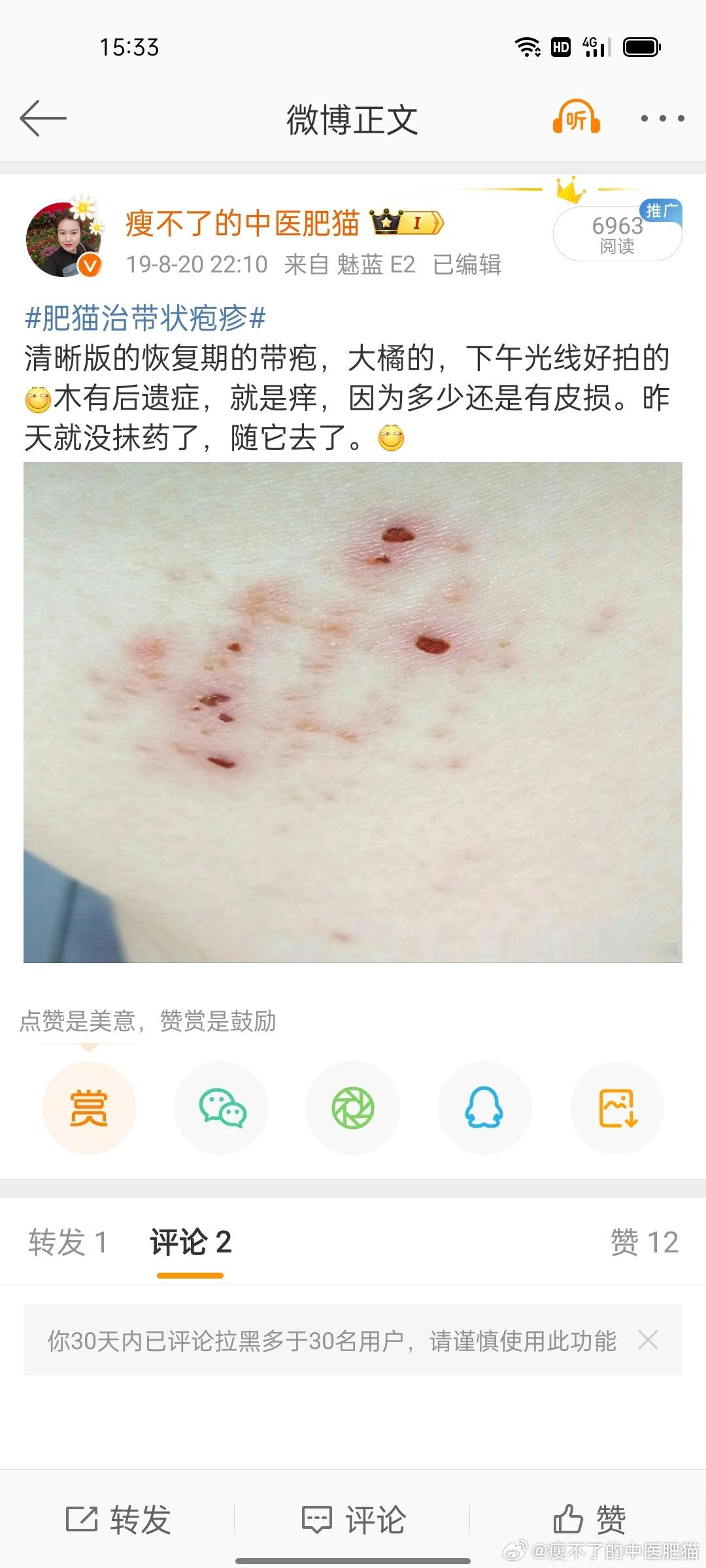 #全民疼痛疾病攻略##疼痛疾病中医怎么治##国医的精诚力量##肥猫治带状疱疹# 