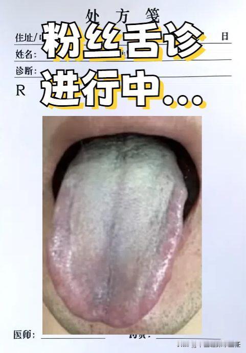 舌边鼓胀就算了，还有血瘀问题，一看肝郁时间就很久了，吃一箩筐的逍遥丸也没用了！