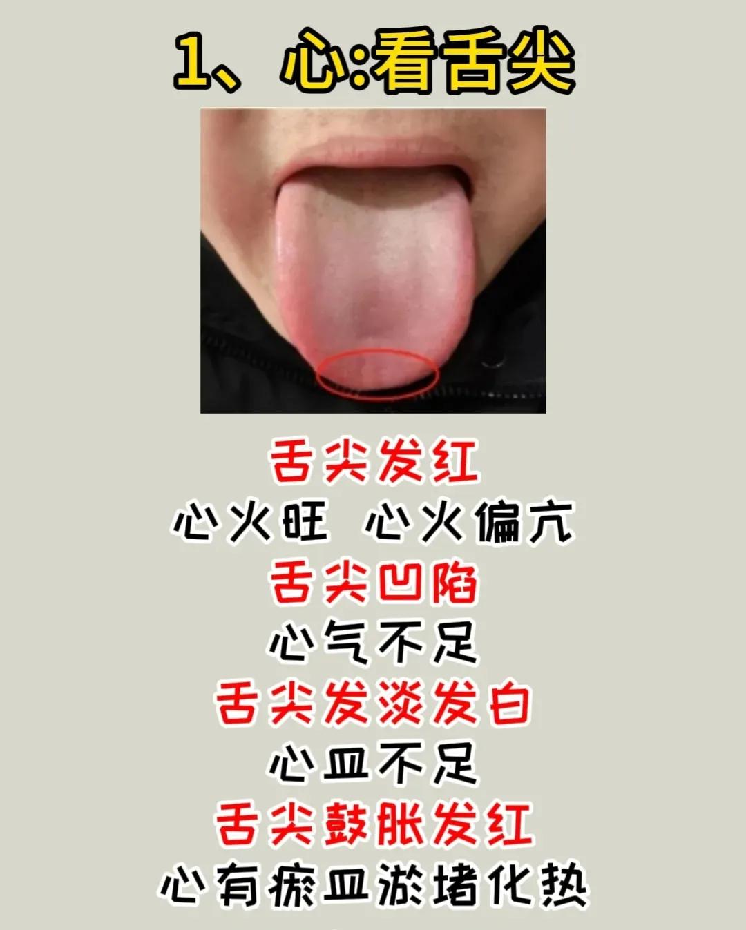 舌头是健康的晴雨表，通过观察舌头的不同部位，我们可以了解五脏六腑的健康状况。［图