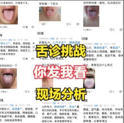 舌象分析，你拍我看，目前人不多！

现场见分晓：
1.不加美颜，滤镜
2.完整露