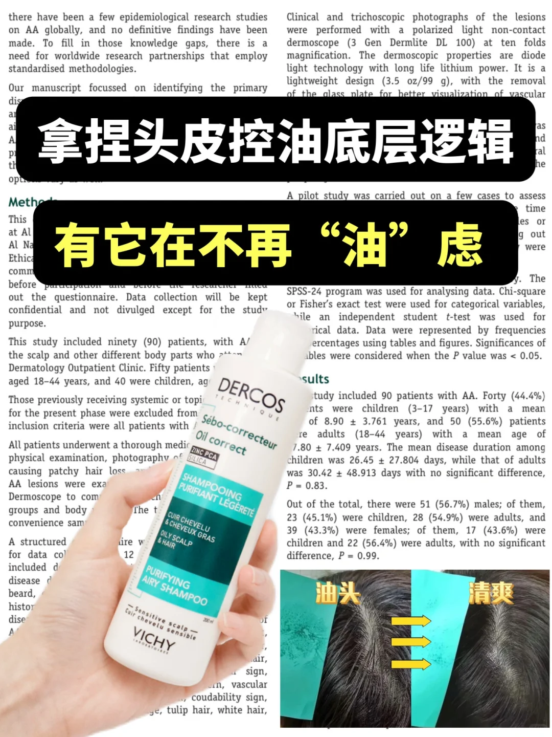 不再“油”虑！一瓶养出瀑布蓬松发！