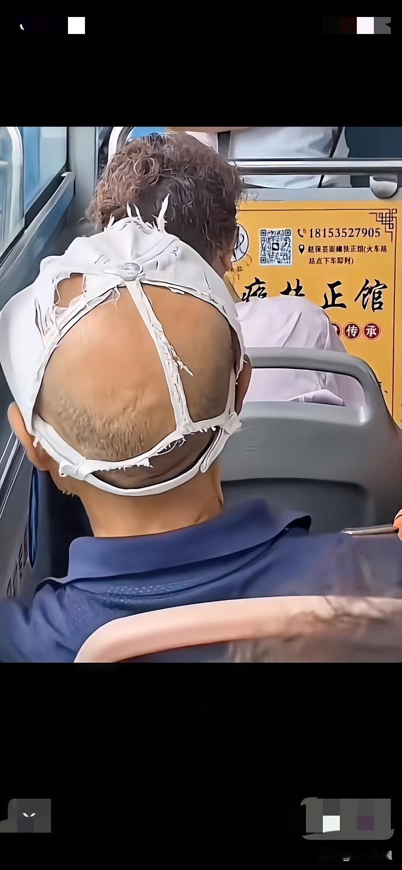 突然在网上看到了一个神奇的大爷，戴着这顶没了半个头部的帽子，秃秃的后脑勺都露出来