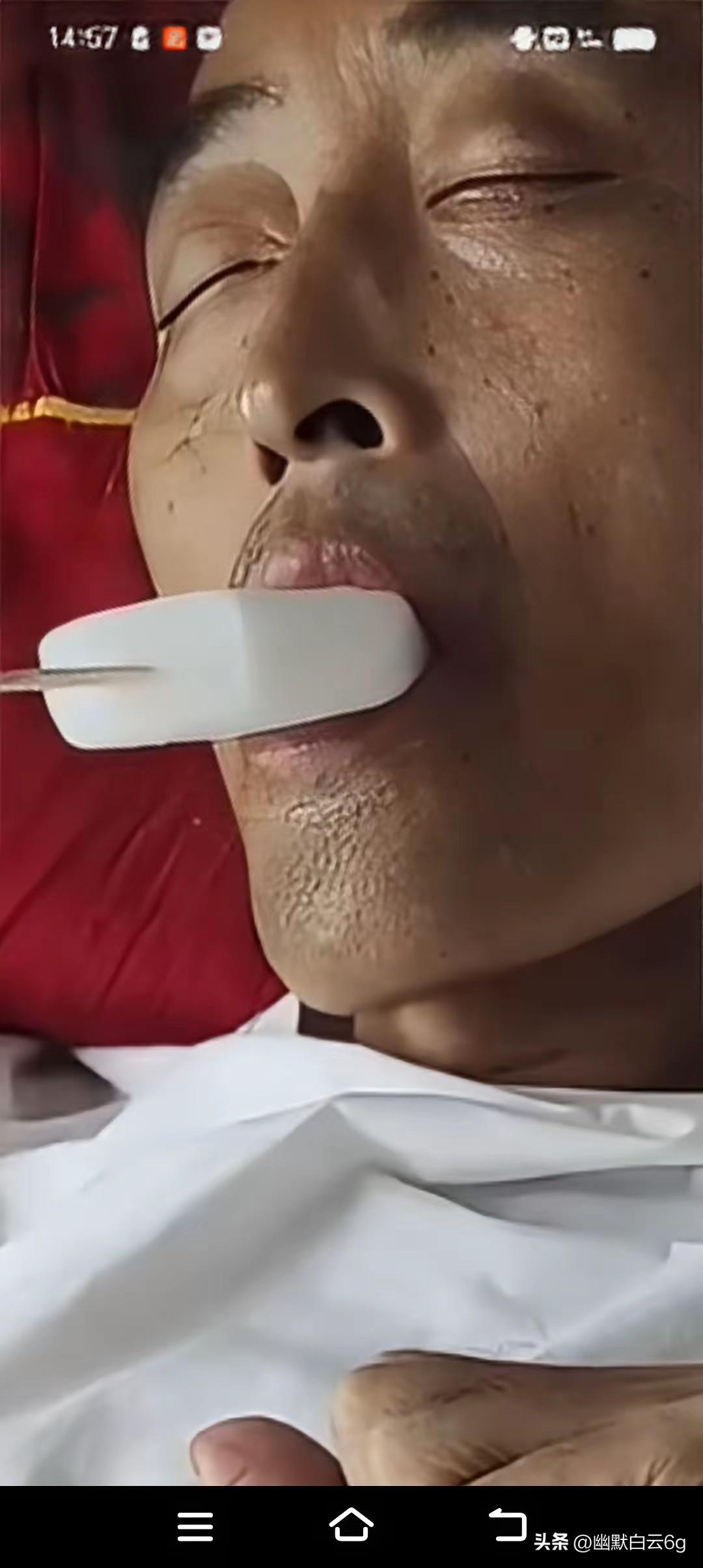 看得心里发酸，肠癌晚期的丈夫已经五天吃不下东西，只能靠着营养针维持身体。难受煎熬