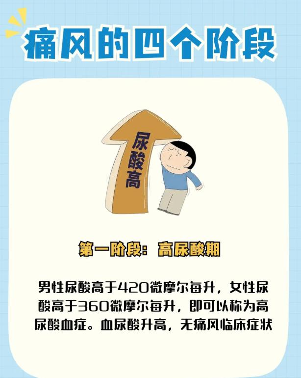 健康科普：详解痛风的四个发展周期与特点