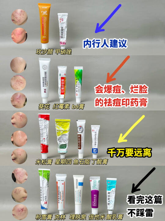 医学生揭露：霸榜痘印药膏才是智商税重灾区
