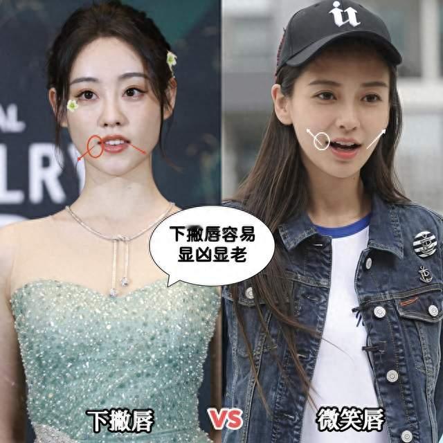 鼻塌算什么，下撇唇才可怕，显老苦相，难怪大家都喜欢“微笑唇”