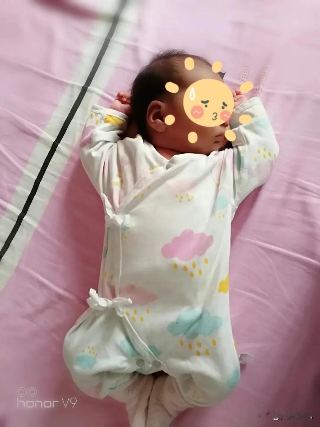 婴儿在医院出生四天后因黄疸照蓝光而死亡。作为一个有经验的人，我想说4点
1、我不