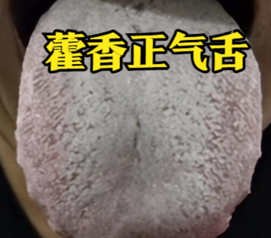 清热祛湿别瞎吃！分清2种舌象，对症调理才见效

一、藿香正气水：寒湿专用，舌胖苔