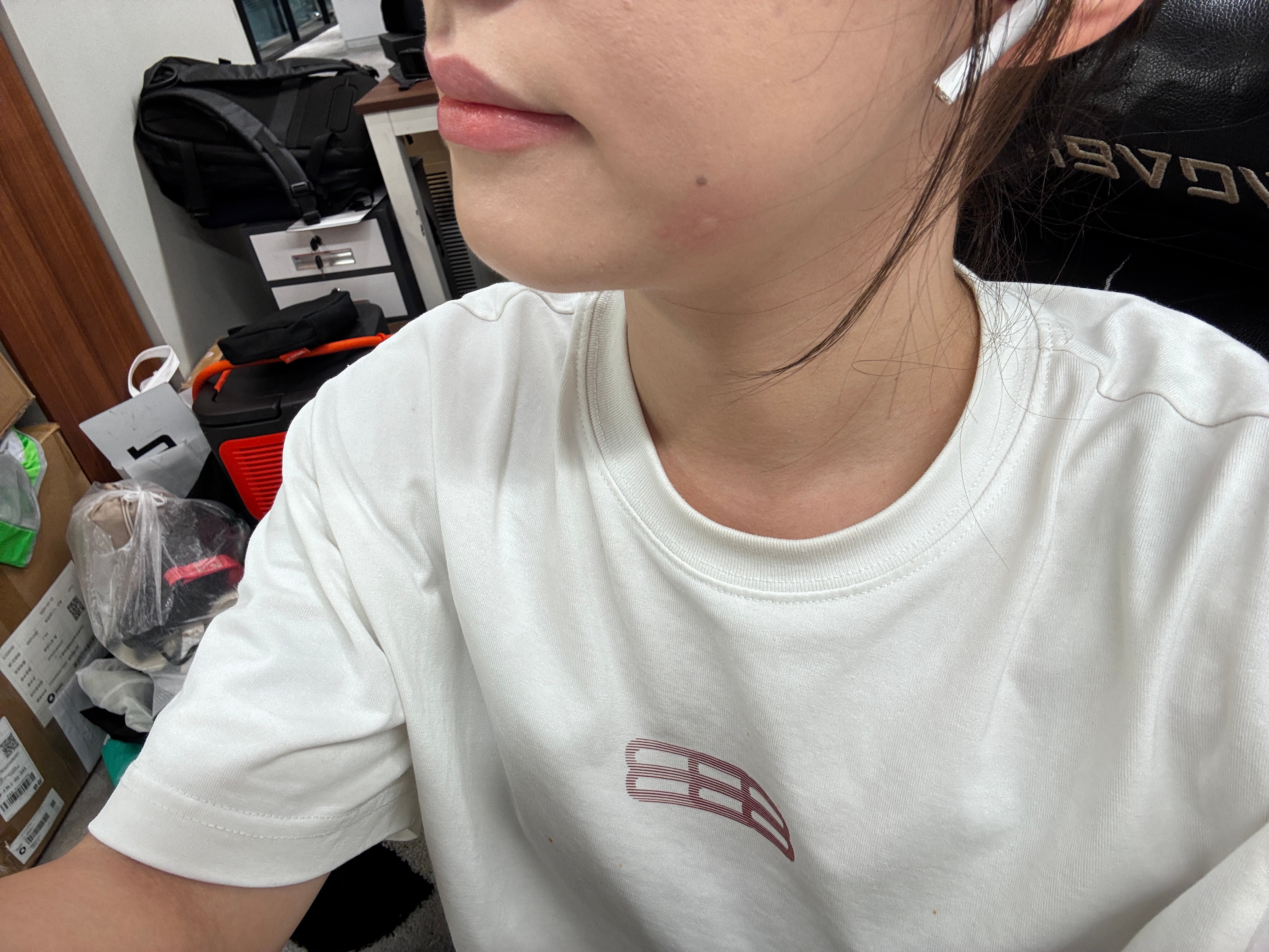 妈耶，公司门口的蚊子太猛了~在楼下摸鱼还没五分钟，那是咔咔嘬我嘬就嘬，但咬脸是怎