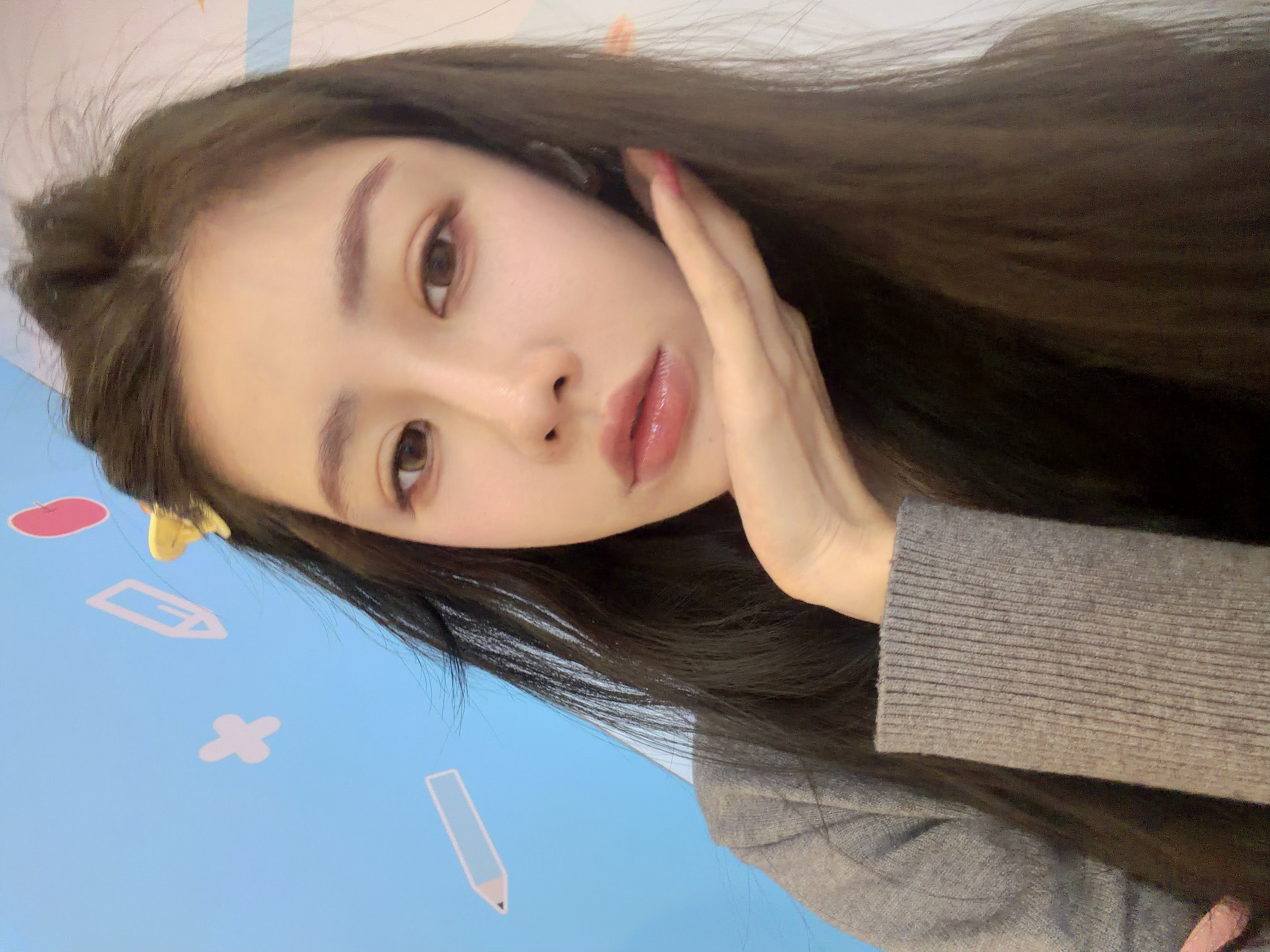 两年没打嘴巴了 上次上班被老板问了下微笑唇好像没了 所以上周补了 结果肿了一周！