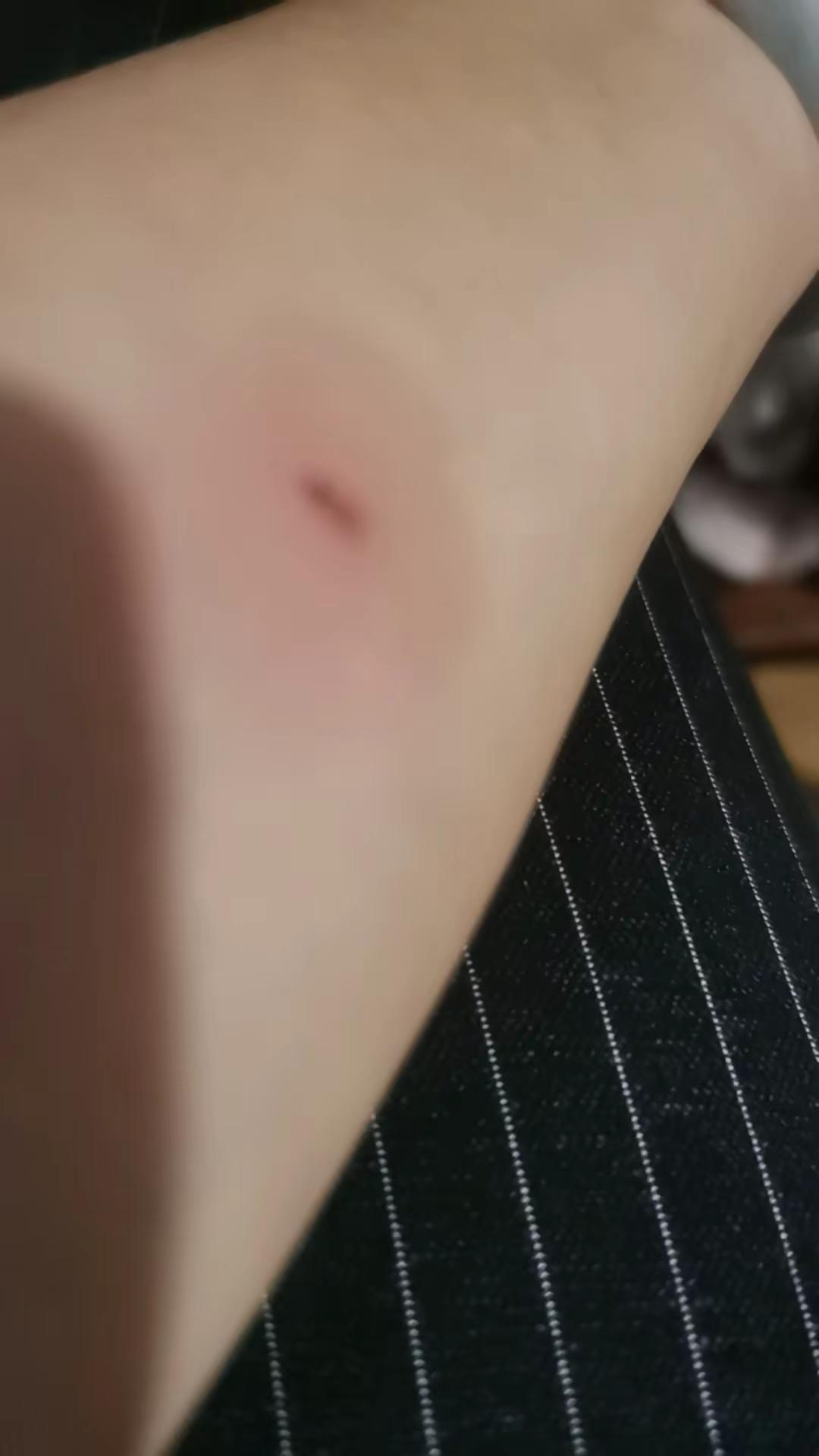 这算不算工伤。要去鉴定算几级伤呢？不知道老板老板娘又可认账呢