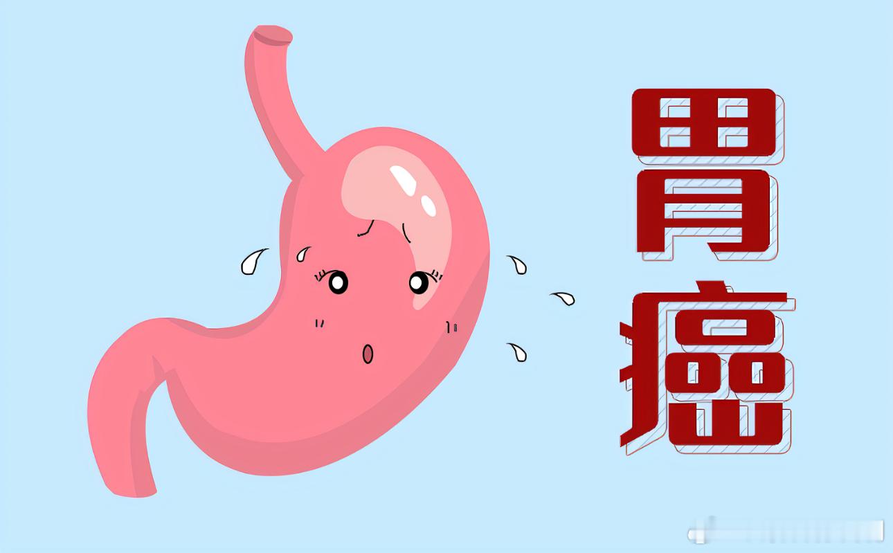 #胃癌可能是个e人##胃癌的发生是一个长期的过程##向肿瘤说拜拜# 【哪些人是胃