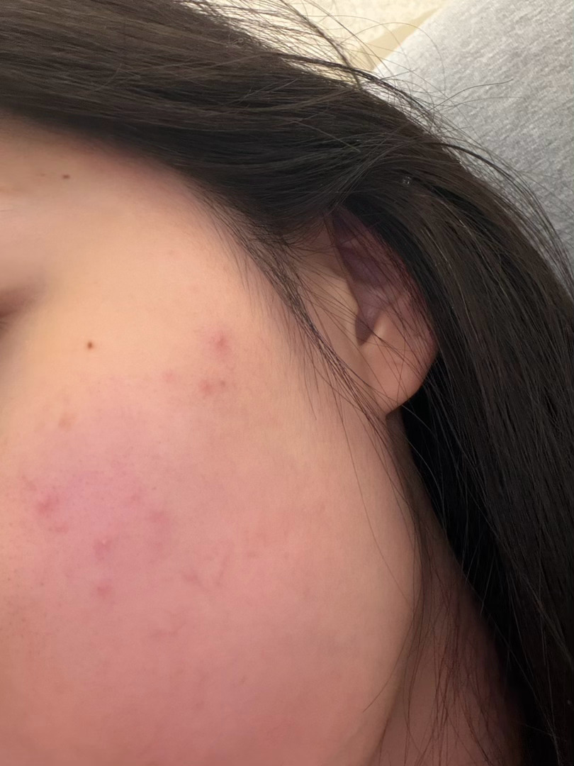 我对猫的过敏程度已经到达了一个巅峰 我家狗去宠物店洗澡跟猫玩了一下我回来抱她我就
