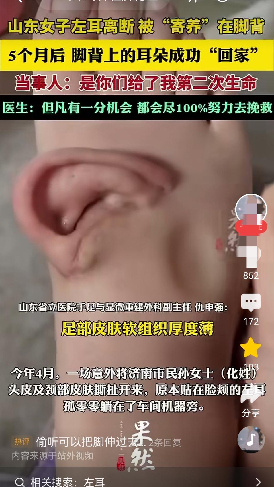 “耳朵长在脚背上”，这图片把我吓一跳。但这也勾起了我的求知欲，耳朵都离开头了，为