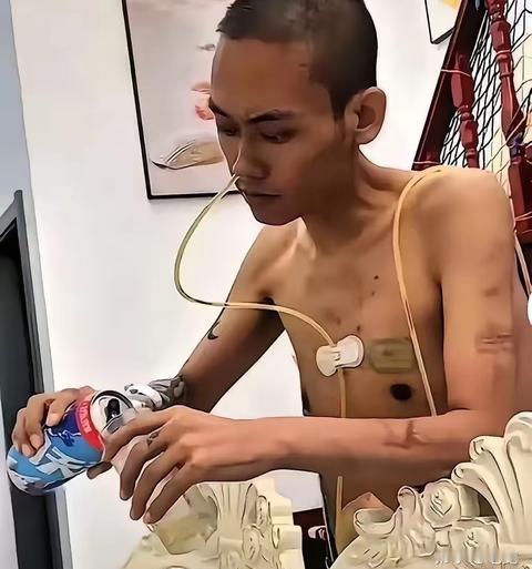心酸！一男子癌症晚期，他主动放弃治疗，自己买了一箱啤酒喝，医生看到后劝其别喝，说