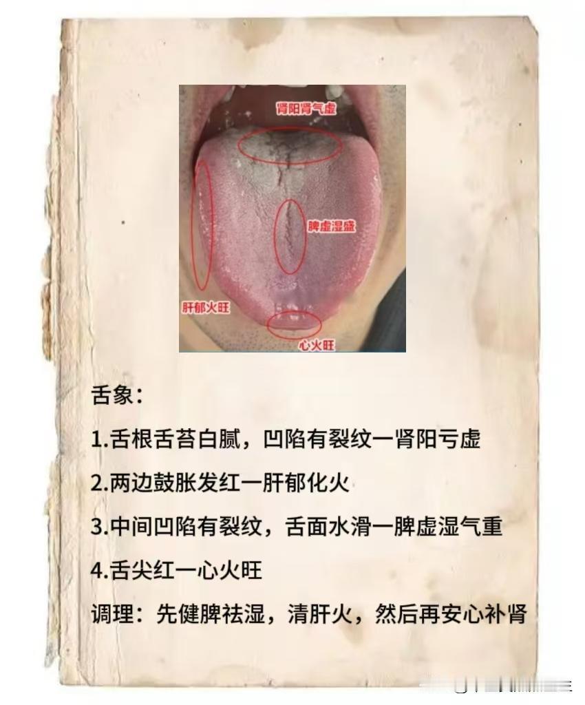 今日舌诊挑战，全网看够88个舌象，你发我辩证，全天在线解答！