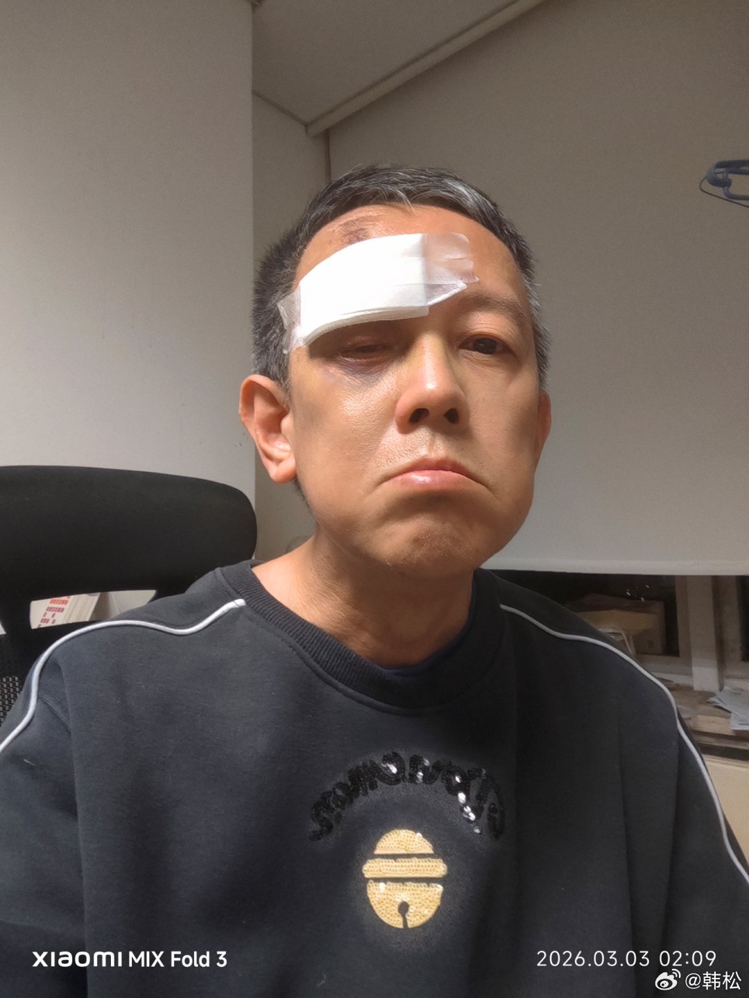 被快递电动车撞倒的第六天。去医院换了药。肿和淤血消了不少。感觉好多了。一直在等待