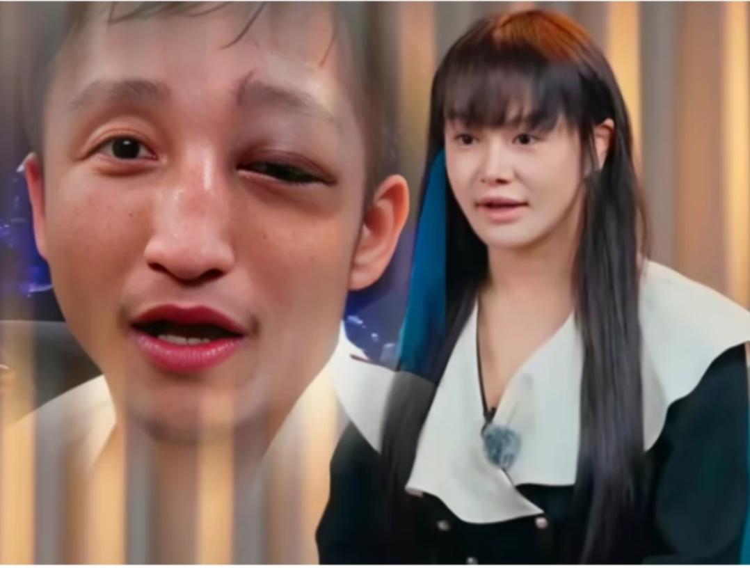 邹市明，眼睛一次次的受伤，视力不会受影响吧？