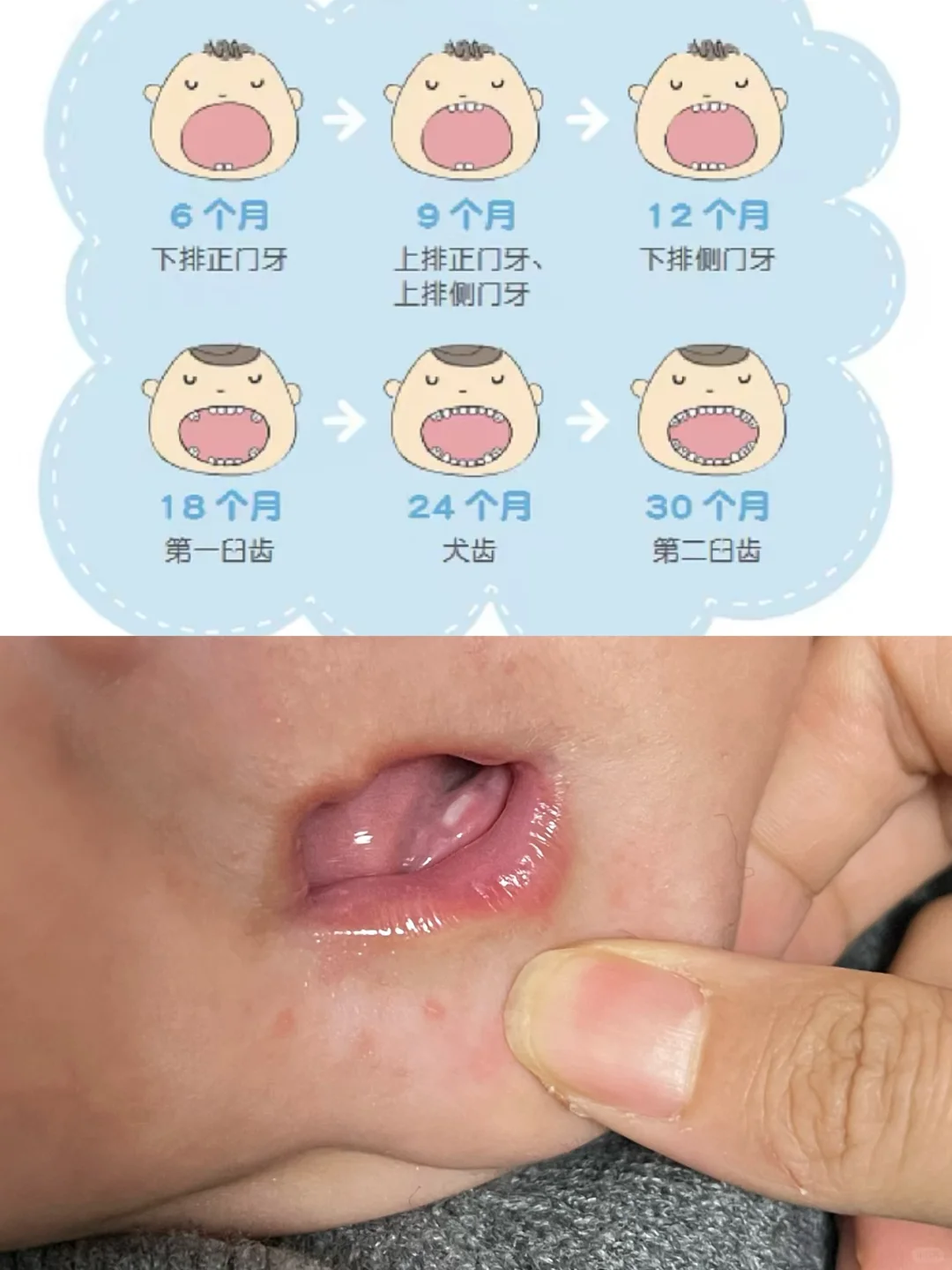你们家宝宝多大长牙🦷我们五个月