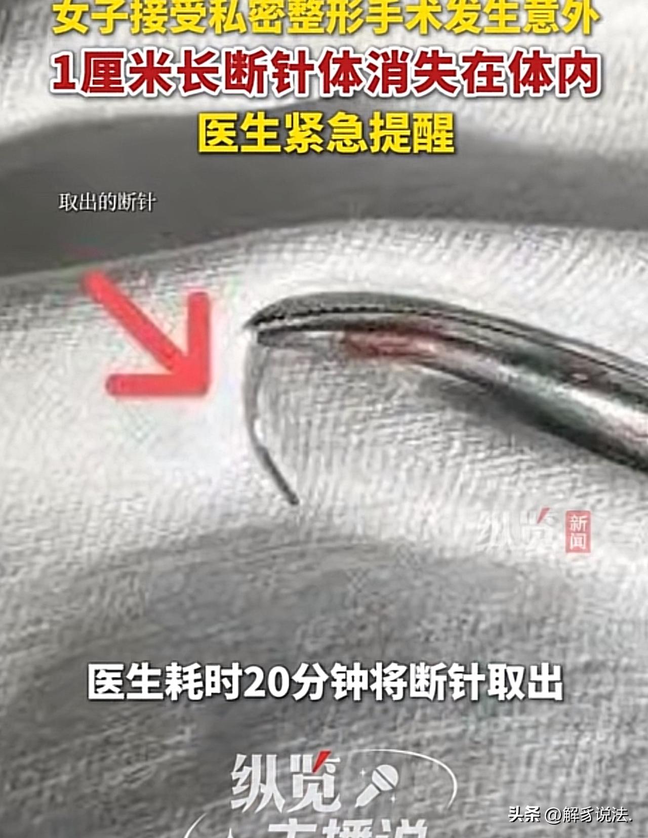 “替她捏了一把汗！”浙江，一女子生完孩子后，担心被丈夫嫌弃，于是，到一家私立美容