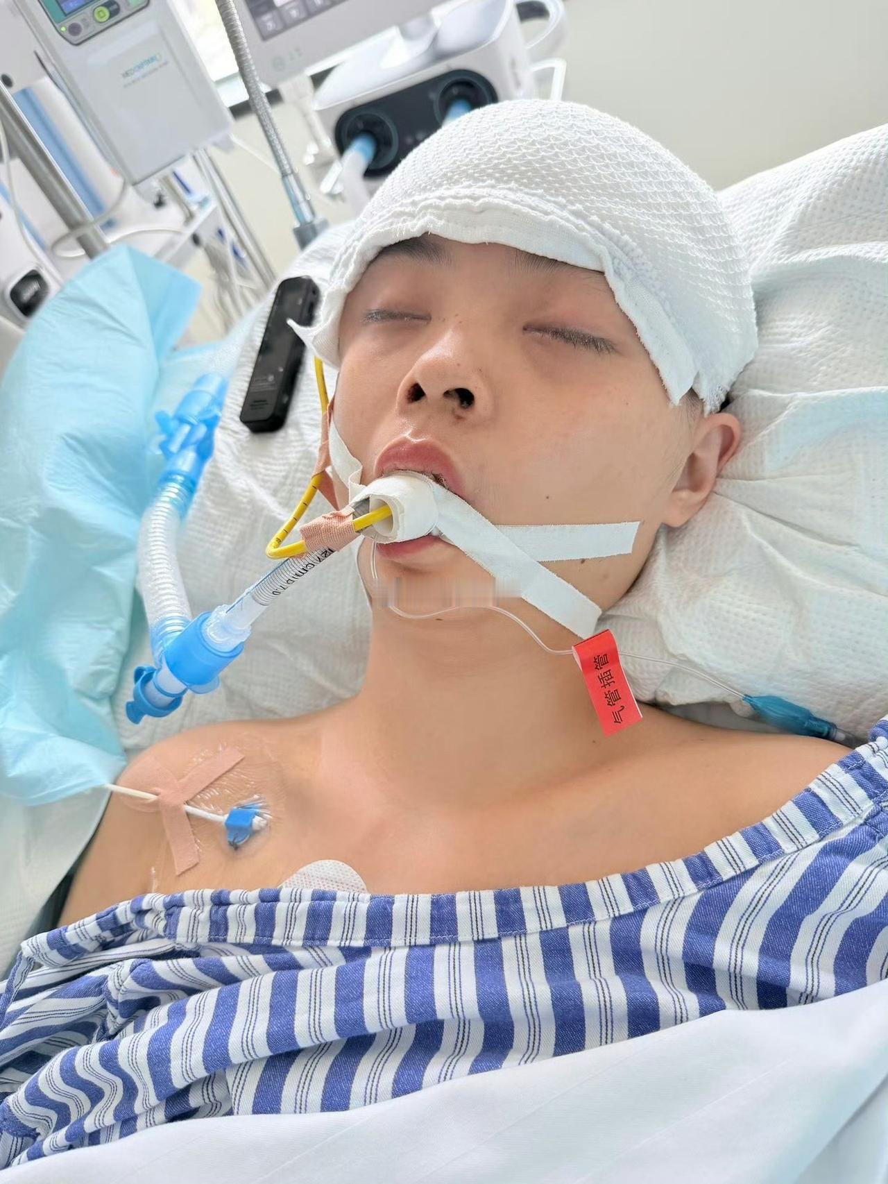 绝对有关系！护士们太不容易了！
30岁的女护士倒在了工作岗位上，脑出血被送往医院