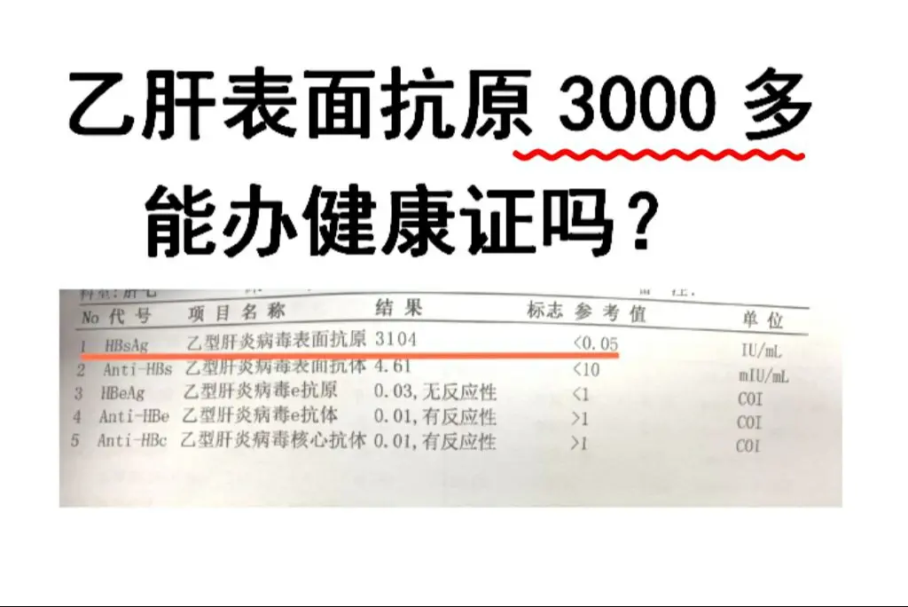 乙肝患者者能不能办健康证呢？ 现在健康证的办理，没有这个乙肝五项检查...