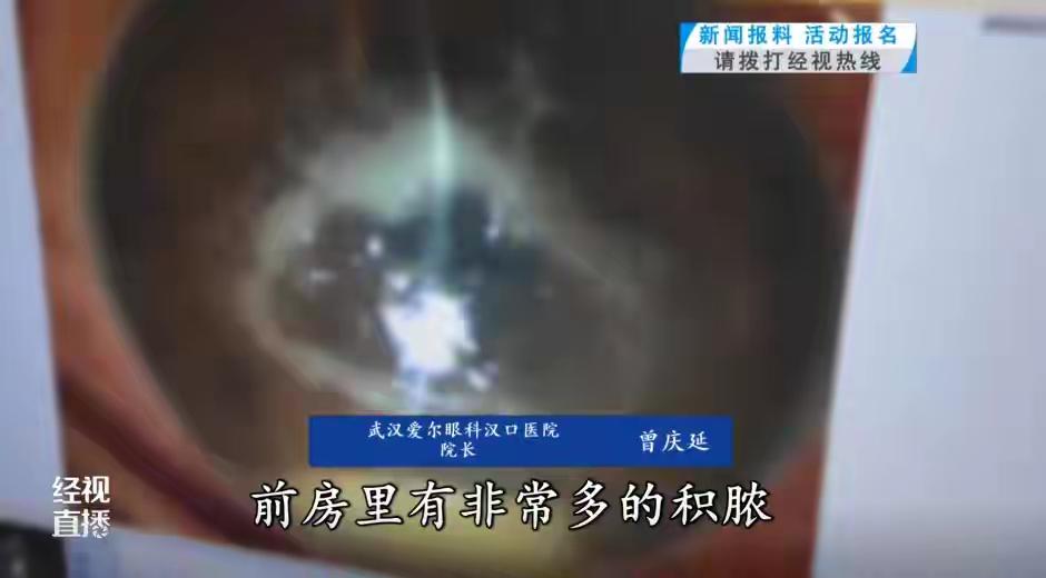 太意外了！武汉，一女子外出游玩，在采莲蓬时，眼睛被蜻蜓“撞”了一下，竟险些失去眼