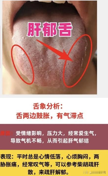不开心就会郁啊，你吃的东西不消化也会郁啊，痰湿多了也会堵着，人不喜欢堵的，最怕就