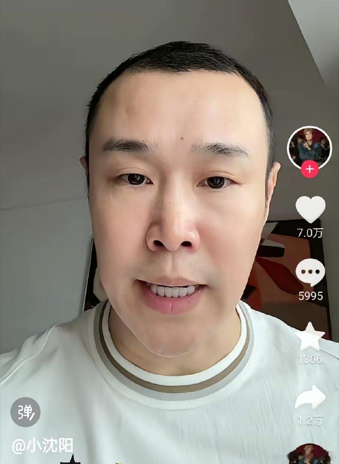小沈阳怎么回事？才45岁的年纪，头发就稀疏成这样，脸也皮肤松垮了，怪不得网友让他