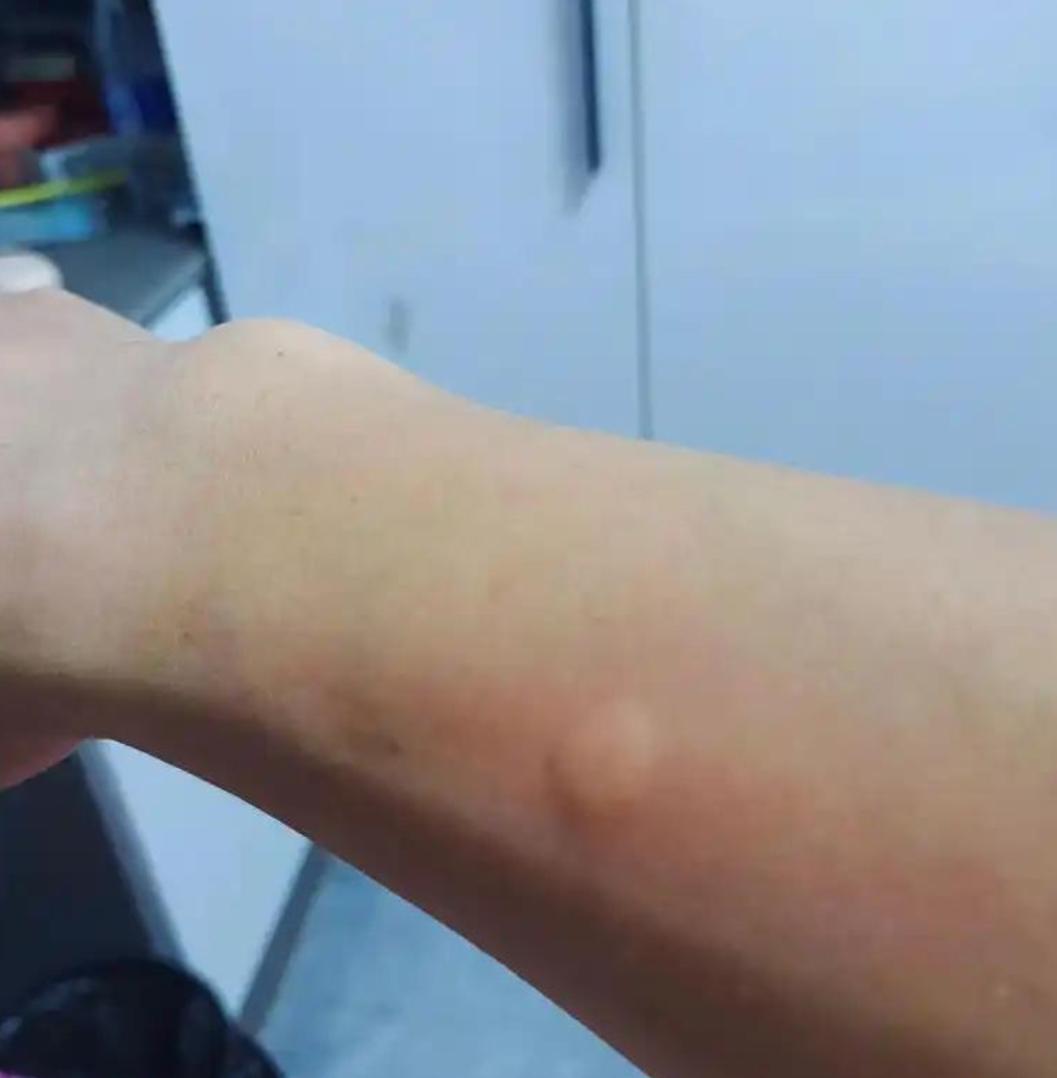 是我太娇嫩了吗？孩子爸那一声叹息，让我心里好凉。

今年老家的夜蚊子特别多，而且