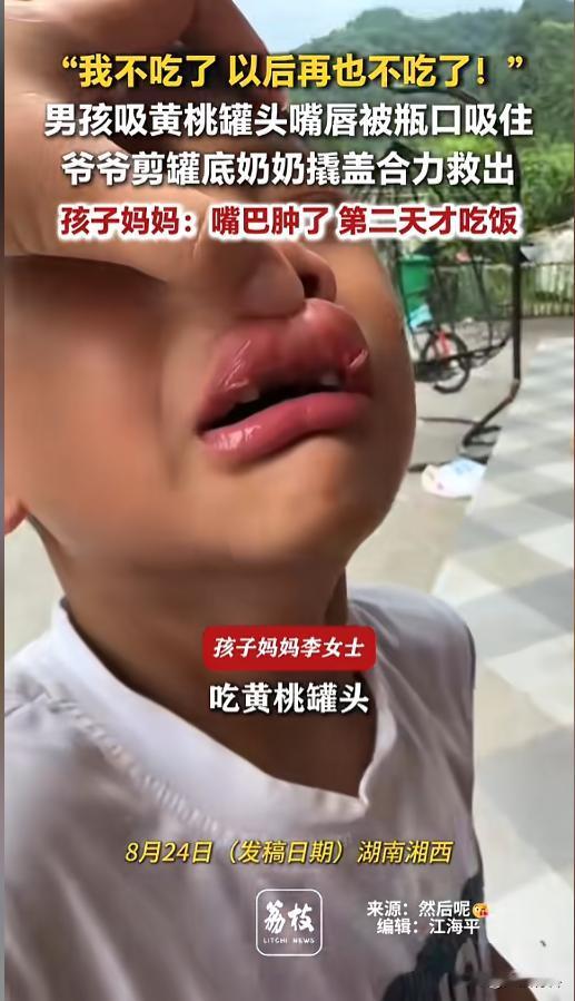 “留下心理阴影了！”8月24日报道，湖南，男孩吃黄桃罐头，结果刚拉开一个口，拉环