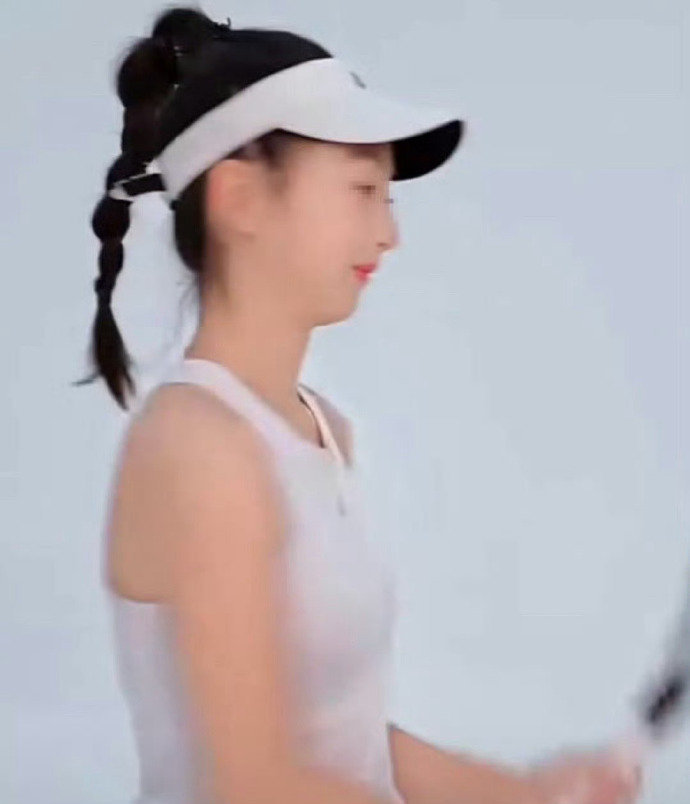 ​之前大家热议的下巴后缩问题，经过家人和她的不写努力，通过矫正已经好很多了，已经