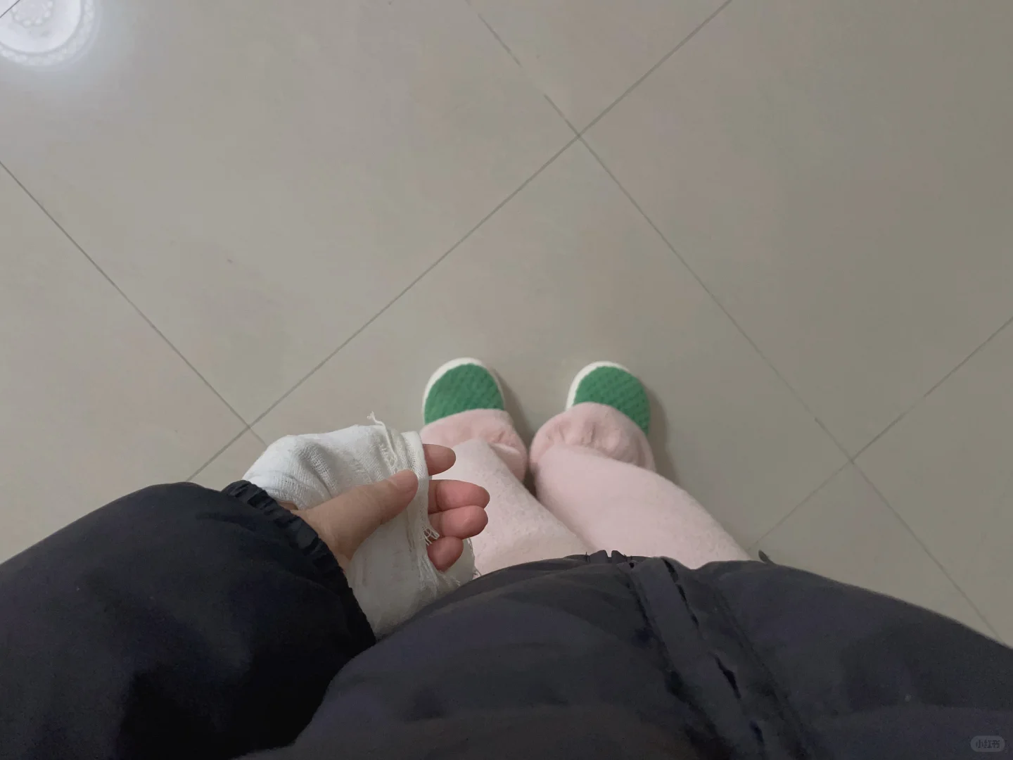 打石膏生活的第六天