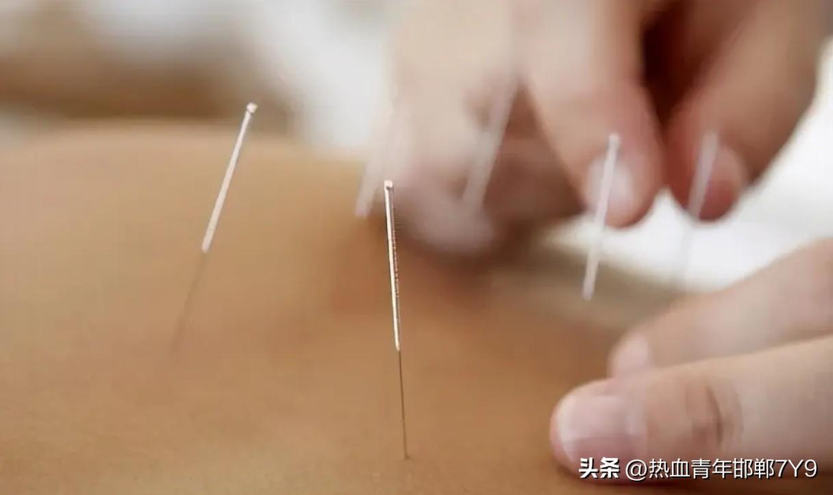 中医针灸效果到底怎么样？
今天，由于腿部不适，听从家人劝告，在浙中老家浙四医院共