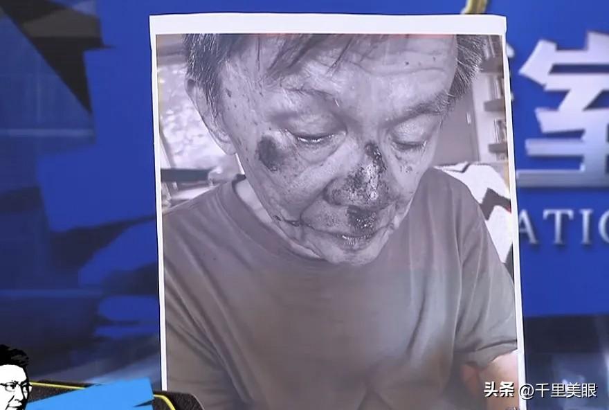 87岁台湾名嘴沈富雄在节目中透露自己意外重摔，老年人最可怕的就是摔跤，有很多老年