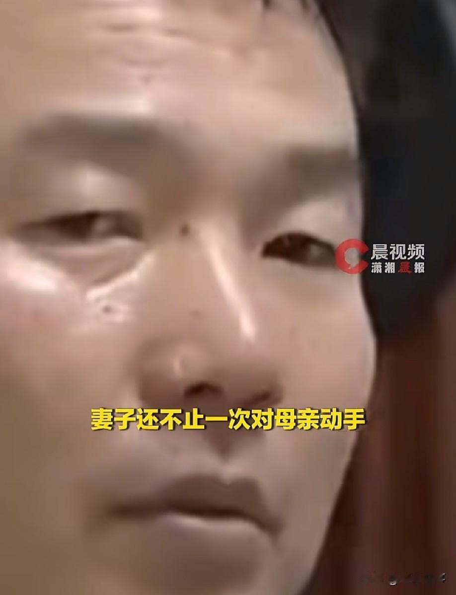 娶了媳妇忘了娘。
浙江，母亲因为不帮忙带孩子，就被儿媳妇打断4根肋骨，儿子不仅不