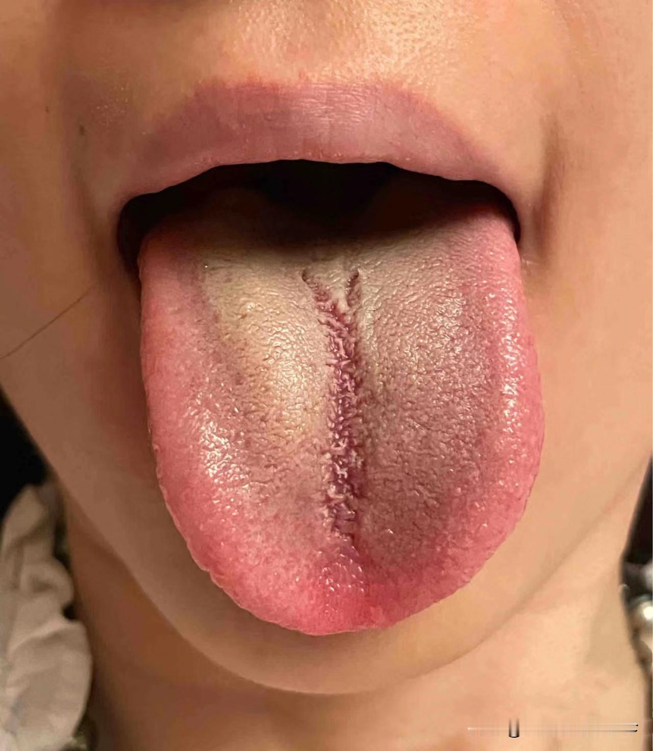 姑娘，你连吃的饭菜的都吸收不了，再补也只是空欢喜一场！

前两天门诊的一位小姑娘