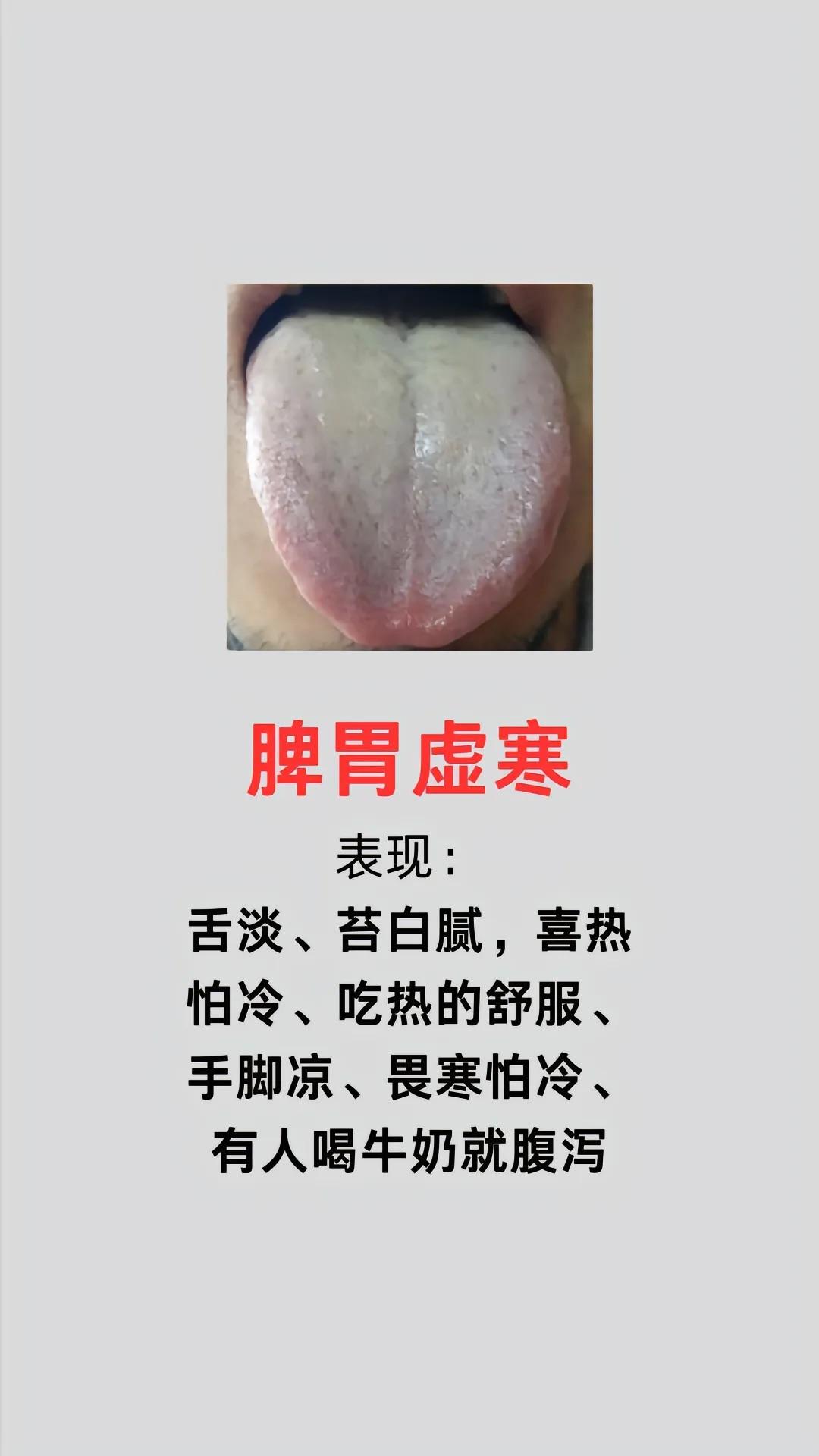 脾虚不止一种！今天分享6张舌象图片，让你一次搞清楚，什么是脾虚！大家可以自己对号