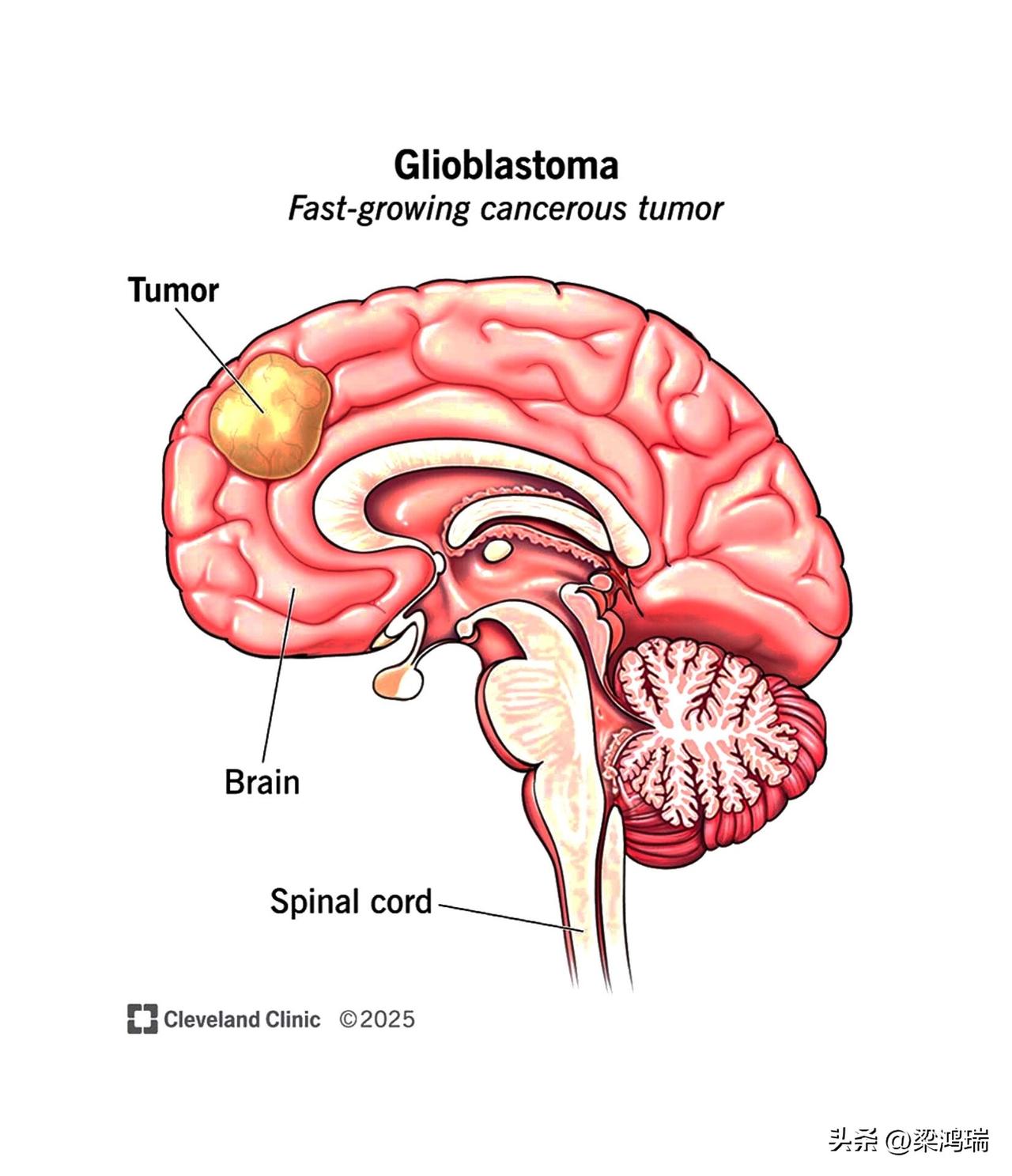 国立台湾大学蛋白质工程团队的科学家们刚刚研制出一种“特洛伊木马”，可以将强效药物