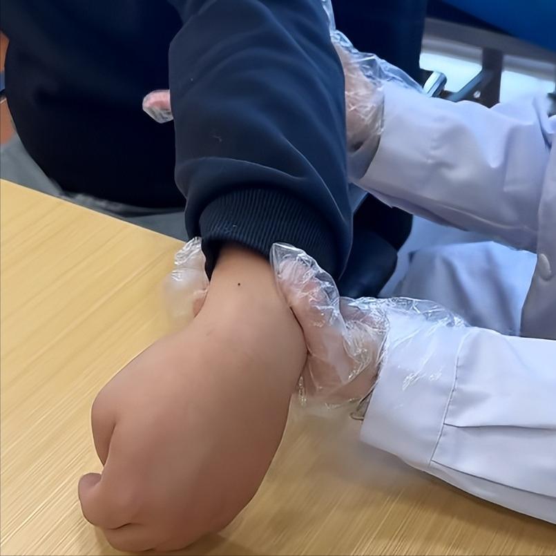 偏瘫后肌张力高会造成三种危害，但愿你一个也没有
危害一：关节变形，活动受限
当肌