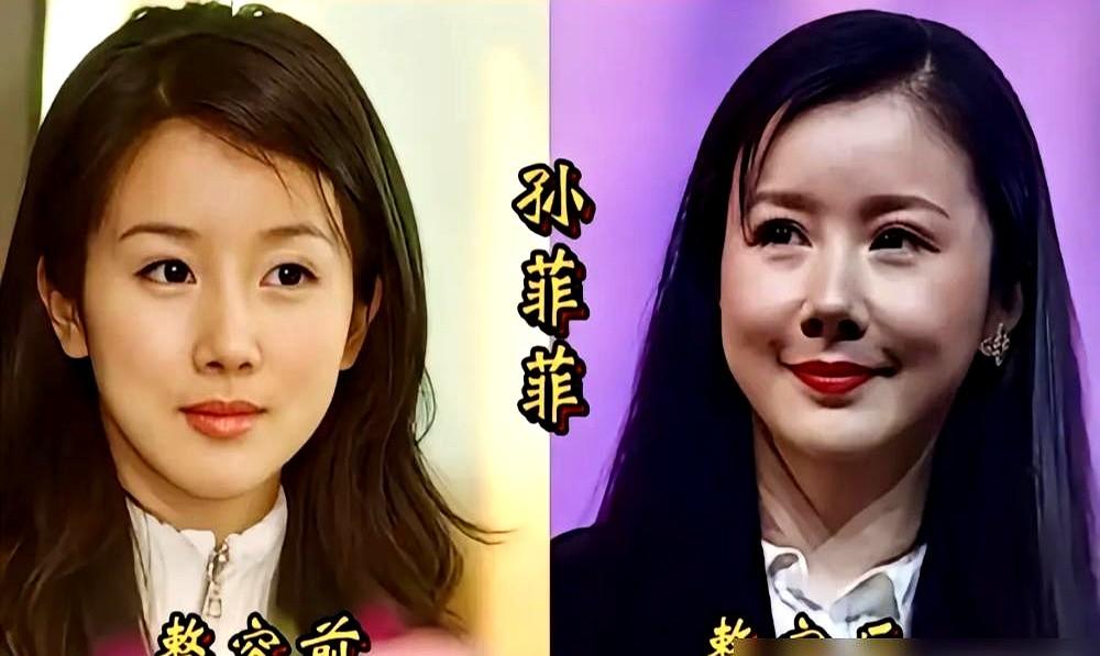 无精修全开麦，硬生生凭着一嗓子撕开一条血路，拿下总排名第5。

总决赛那首我是如