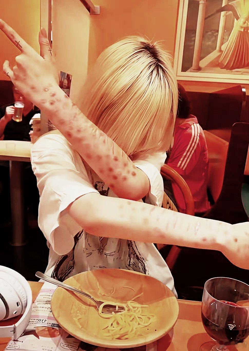 日本梅毒 日本媒体报道，日本梅毒感染人数近年持续处于高位，确诊病例数连续4年超过