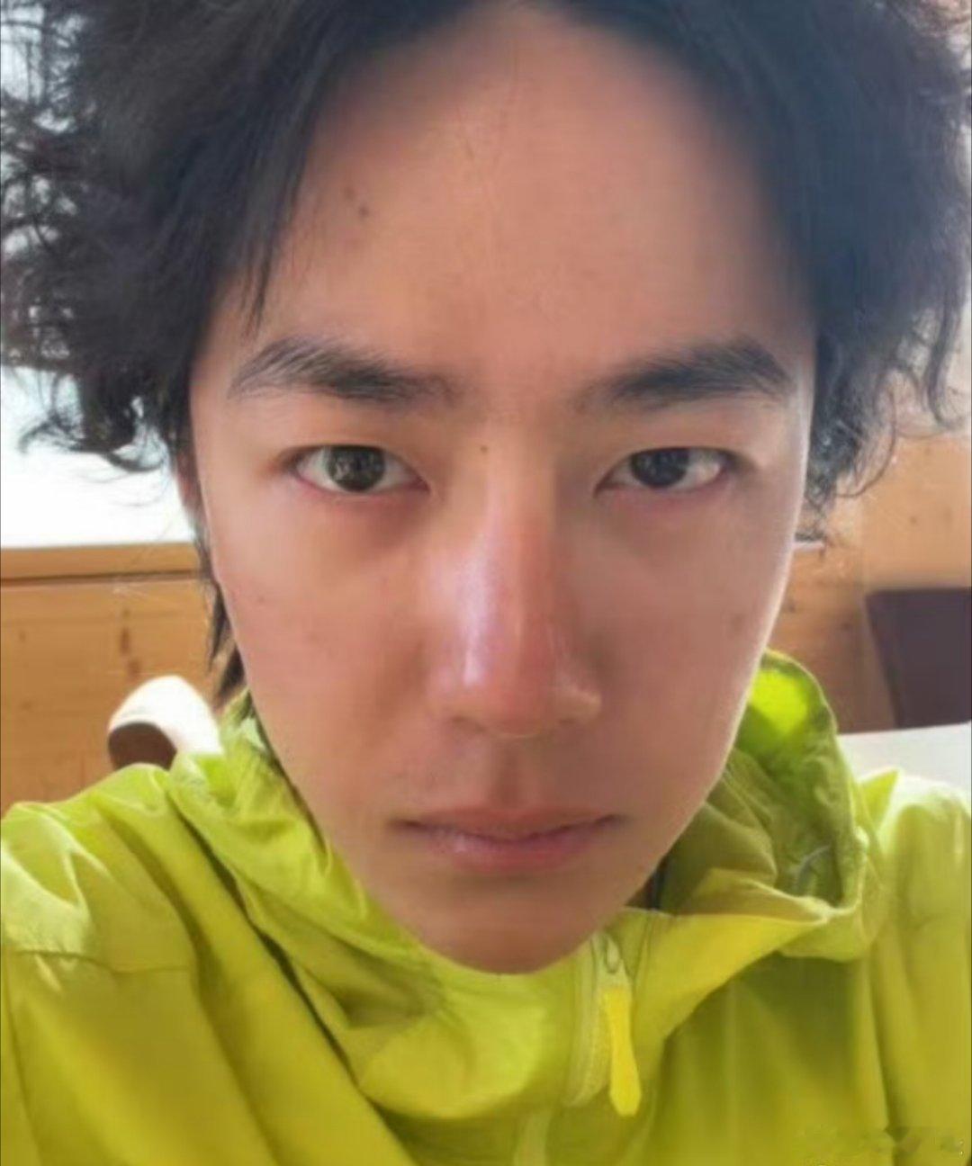 王一博ins素颜自拍天啊素颜怼脸也太敢了吧！这皮肤状态好到离谱，但看到晒伤那块真