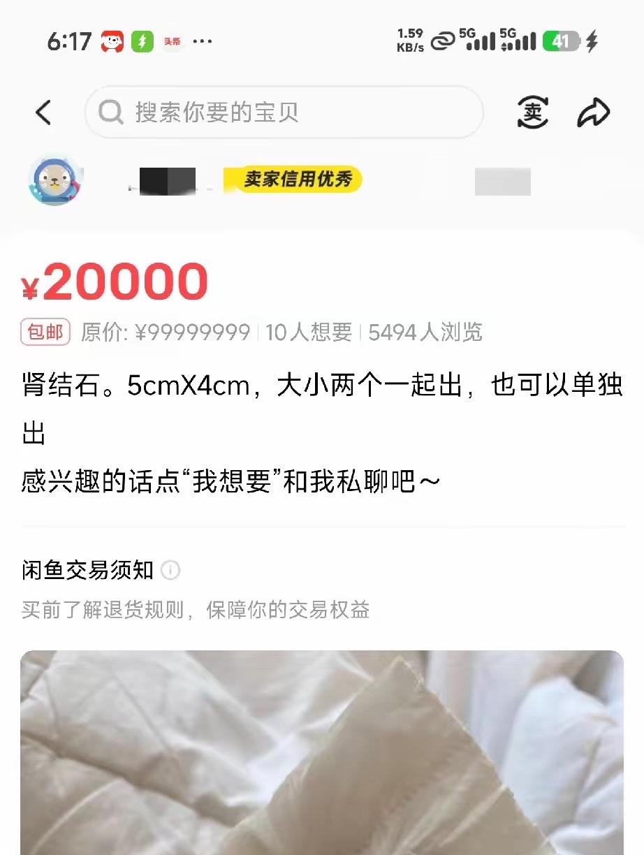 今天刷到个卖肾结石的，

5cm×4cm的大小两个，标价2万，包邮。

这玩意儿