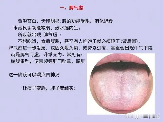 4种常见脾虚舌象，看看你中招了没？#健康##脾虚的表现#