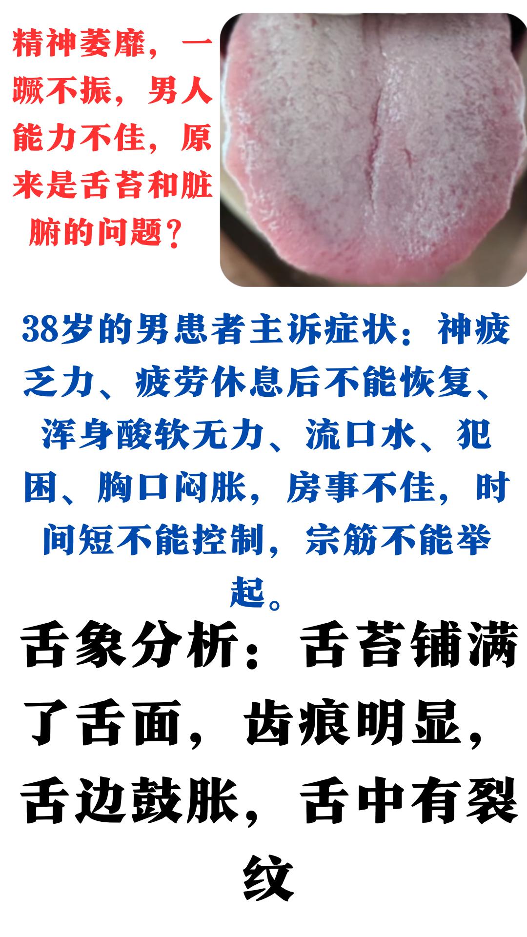精神萎靡，一蹶不振，男人能力不佳，原来是舌苔和脏腑的问题？

肝郁克脾、痰湿粘滞