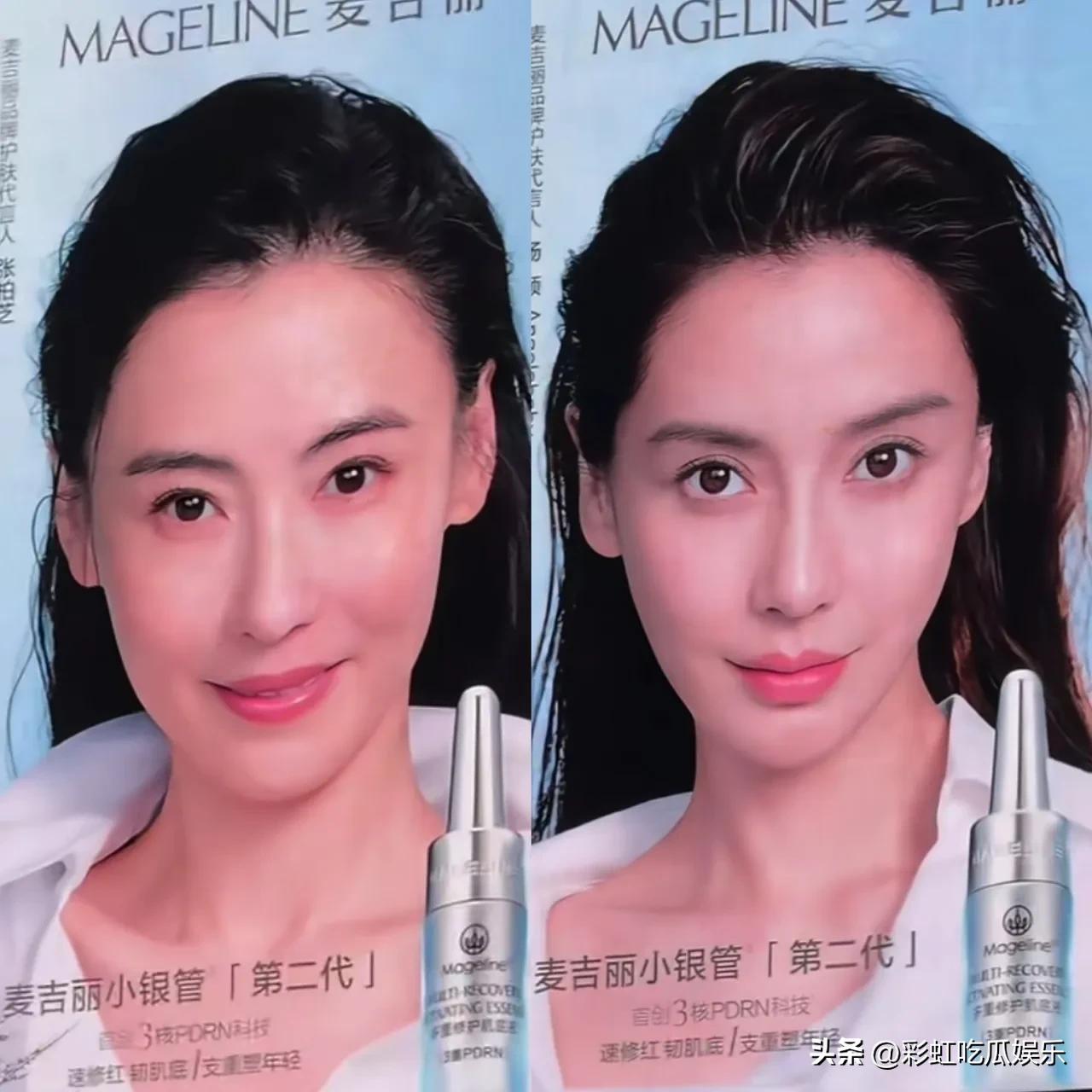 张柏芝和杨颖同为麦吉丽代言人，同人不同命，谁是骨相美高下立判。

张柏芝是天然骨